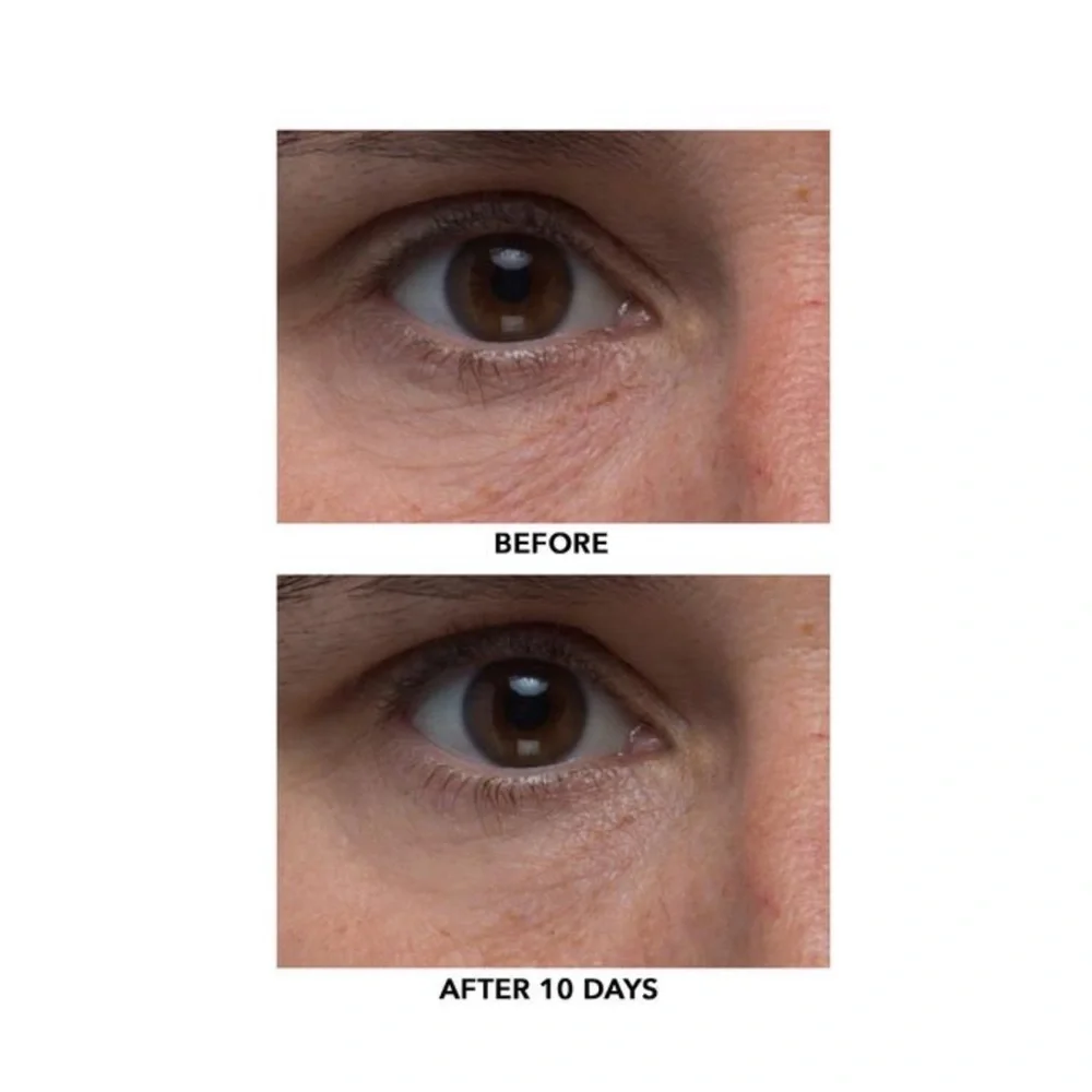 ALGENIST | Triple Algae Eye Renewal Balm